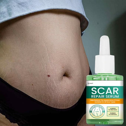 Scar Repair Serum 30ML (Pack of 2)