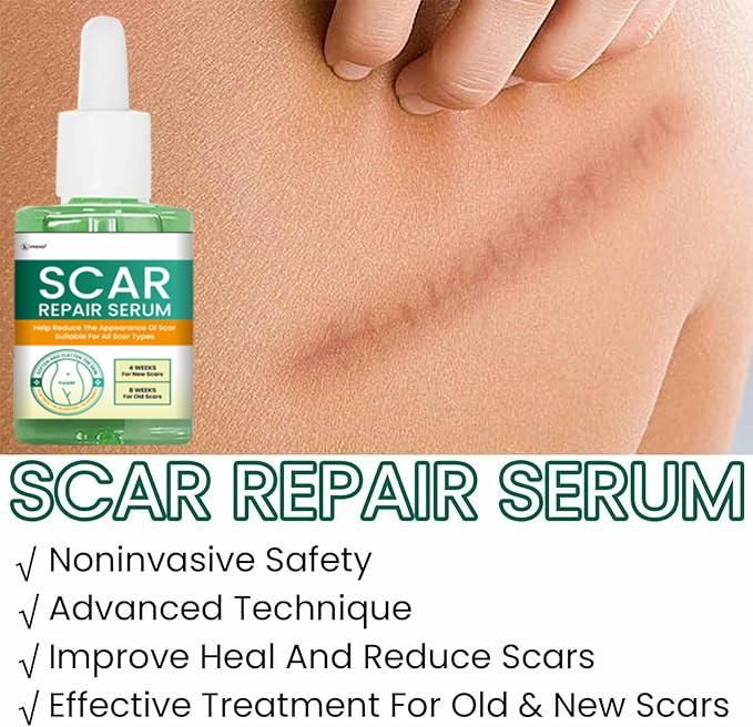 Scar Repair Serum 30ML (Pack of 2)